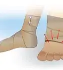 Fasciare una Gamba con una Benda Elastica