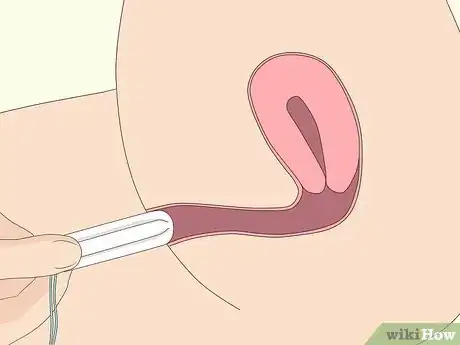 Immagine titolata Insert a Tampon Without Applicator Step 6