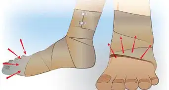Fasciare una Gamba con una Benda Elastica