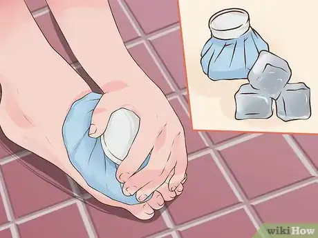 Immagine titolata Tape a Broken Pinky Toe Step 6