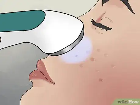 Immagine titolata Get Rid of Cystic Acne Scars Step 11