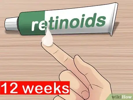 Immagine titolata Get Rid of Cystic Acne Scars Step 19
