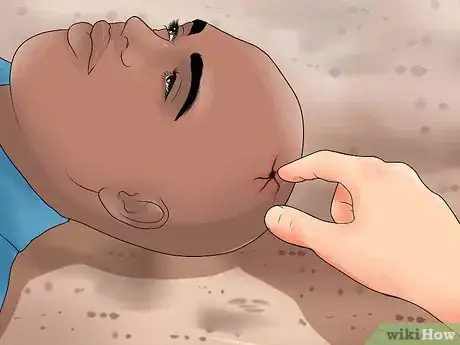 Immagine titolata Evaluate for Head Injuries During First Aid Step 3