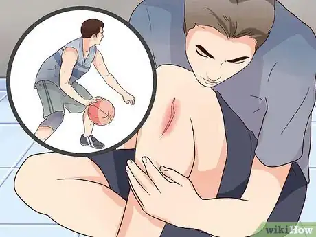 Immagine titolata Get Rid of a Cut Step 3