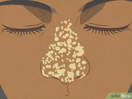 Immagine titolata Clean Nose Pores Step 1