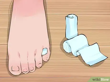Immagine titolata Tape a Broken Pinky Toe Step 3