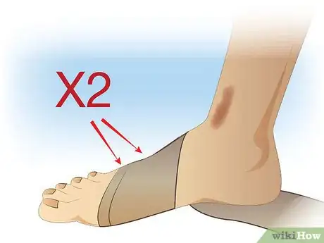 Immagine titolata Ace Wrap a Leg Step 6