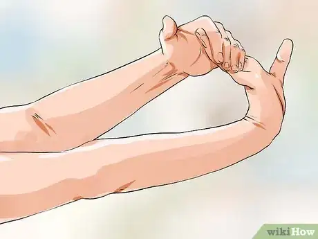 Immagine titolata Treat Carpal Tunnel Syndrome Step 2