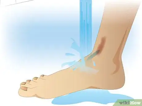 Immagine titolata Ace Wrap a Leg Step 4
