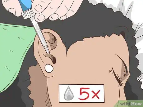 Immagine titolata Get Rid of Ear Wax Step 20