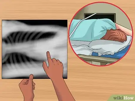 Immagine titolata Read a Chest X Ray Step 10