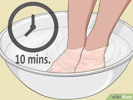 Immagine titolata Tell if an Ingrown Toenail Is Infected Step 5