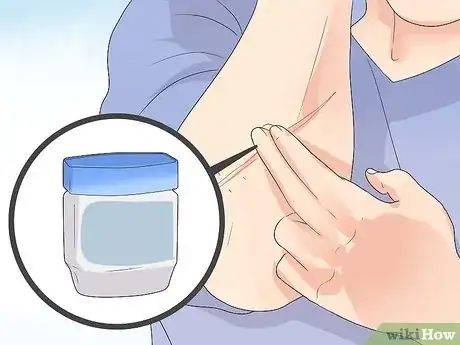 Immagine titolata Get Rid of a Cut Step 11