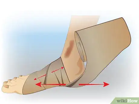Immagine titolata Ace Wrap a Leg Step 9