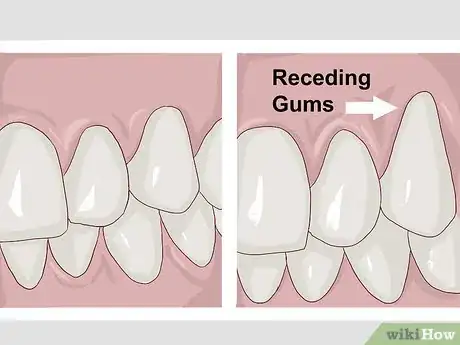 Immagine titolata Stimulate Gum Growth Step 10