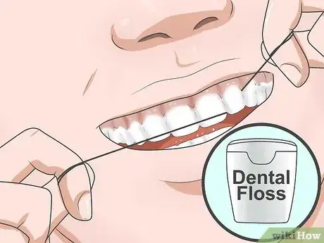 Immagine titolata Reduce Gum Swelling Step 11