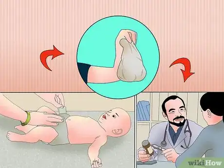 Immagine titolata Treat Diarrhea in Newborns Step 3