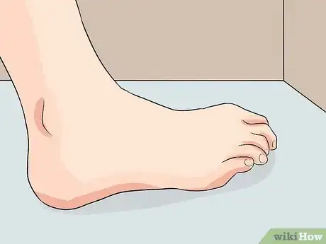 Immagine titolata Identify Achilles Tendinitis Step 4