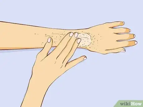 Immagine titolata Have Super Soft Hands (Overnight Method) Step 4