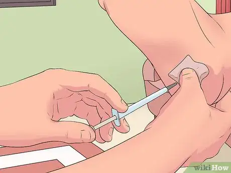 Immagine titolata Treat Plantar Fasciitis Step 9