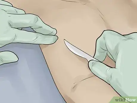 Immagine titolata Embalm Step 10