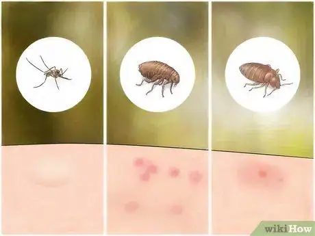 Immagine titolata Identify Insect Bites Step 2