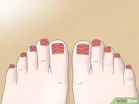 Immagine titolata Perform a Professional Salon Pedicure Step 18