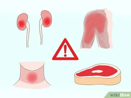 Immagine titolata Bring Down High Creatinine Levels Step 4