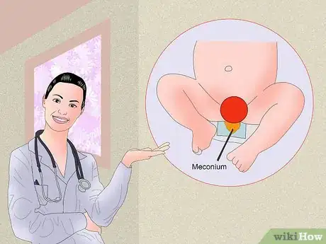Immagine titolata Treat Diarrhea in Newborns Step 4