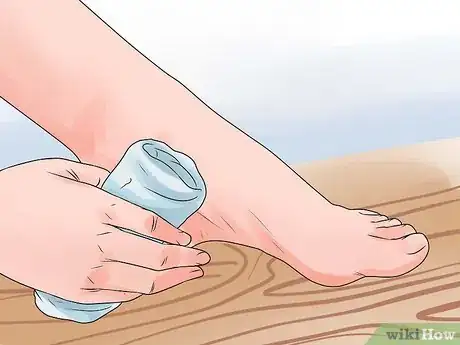 Immagine titolata Care for a Burst Blister Step 2