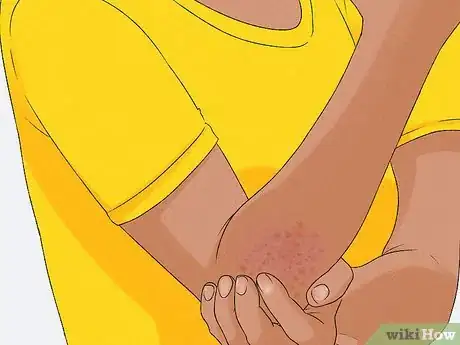 Immagine titolata Recognize Gluten Intolerance Step 8