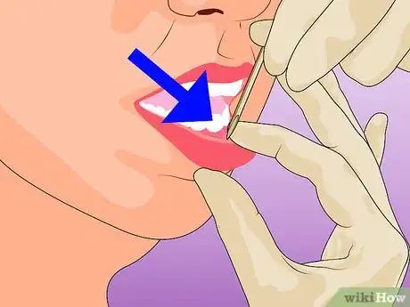 Immagine titolata Pierce Your Own Lip Step 6