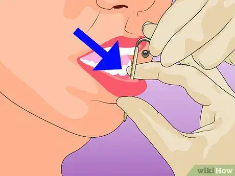 Immagine titolata Pierce Your Own Lip Step 7