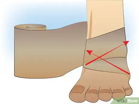 Immagine titolata Ace Wrap a Leg Step 7