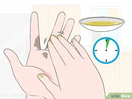 Immagine titolata Get Stain Off Your Hands Step 4