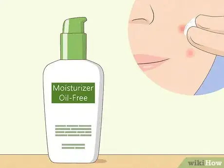 Immagine titolata Reduce the Swelling and Redness of Pimples Step 11