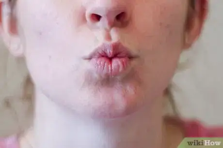 Immagine titolata Heal Sore Lips Step 5