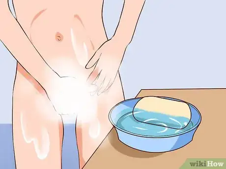 Immagine titolata Insert Vaginal Suppositories Step 1