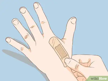 Immagine titolata Apply Different Types of Bandages Step 5