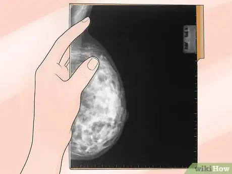 Immagine titolata Prepare for a Mammogram Step 1