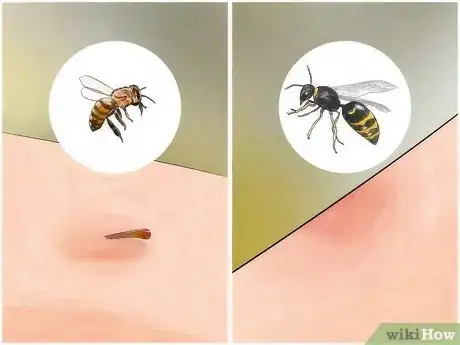 Immagine titolata Identify Insect Bites Step 4