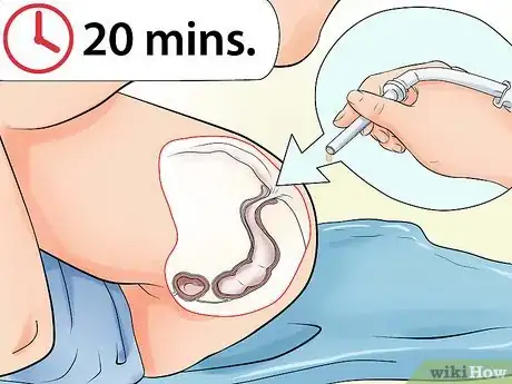 Immagine titolata Make an Enema Step 26
