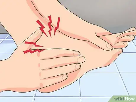 Immagine titolata Treat a Broken Foot Step 8