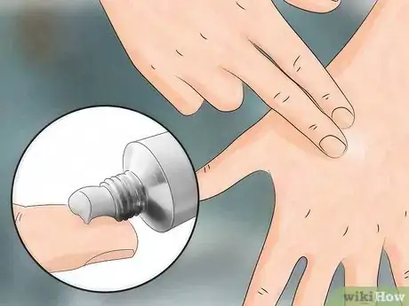 Immagine titolata Reduce the Pain of Gnat Bites Step 5