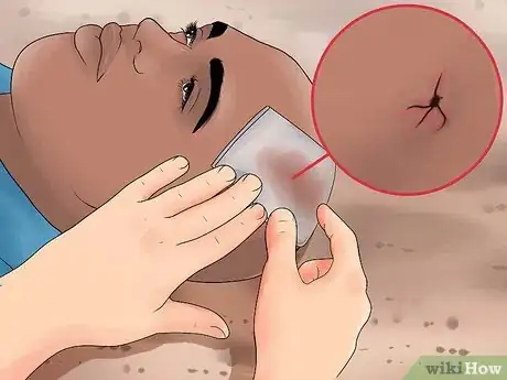 Immagine titolata Evaluate for Head Injuries During First Aid Step 13