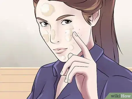 Immagine titolata Get Rid of Cystic Acne Scars Step 15