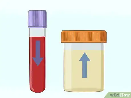 Immagine titolata Bring Down High Creatinine Levels Step 2