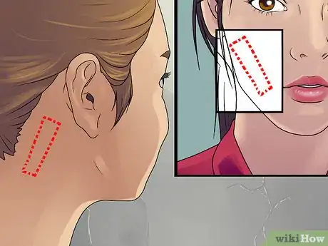 Immagine titolata Get Rid of Cystic Acne Scars Step 12