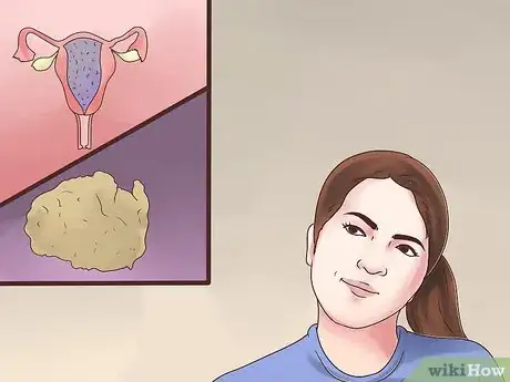 Immagine titolata Prevent Molar Pregnancy Step 9