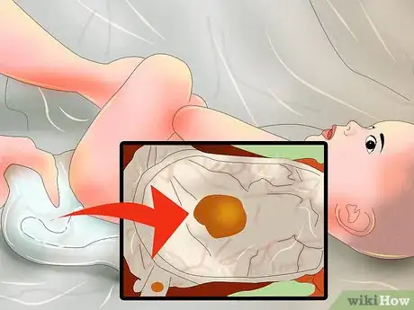 Immagine titolata Treat Diarrhea in Newborns Step 5